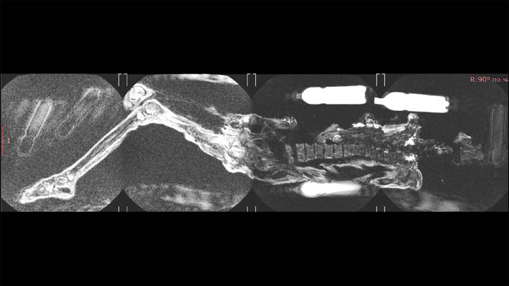 Ukok mummy MRI scan
