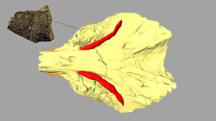 3D reconstruction of the skull