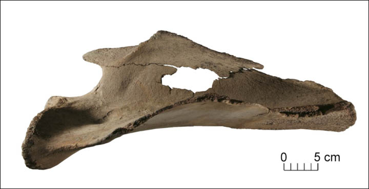 Scapula