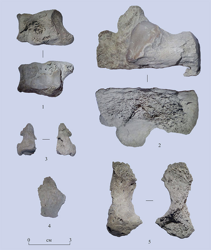 Human bones