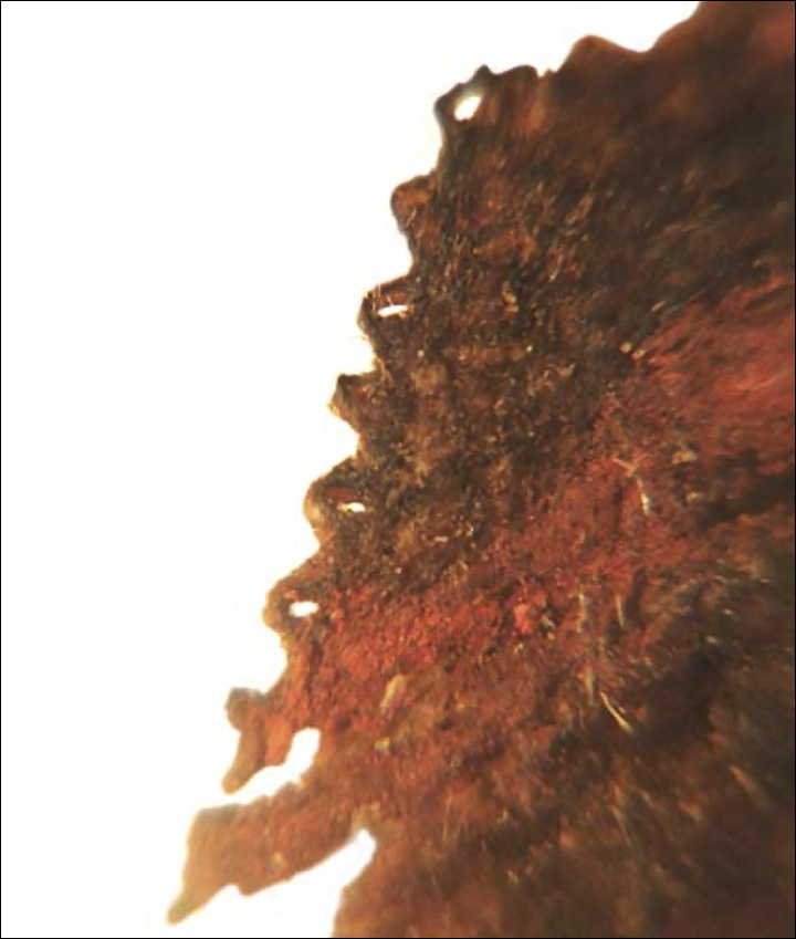 Detail of the cap