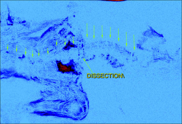 Ukok mummy MRI scan