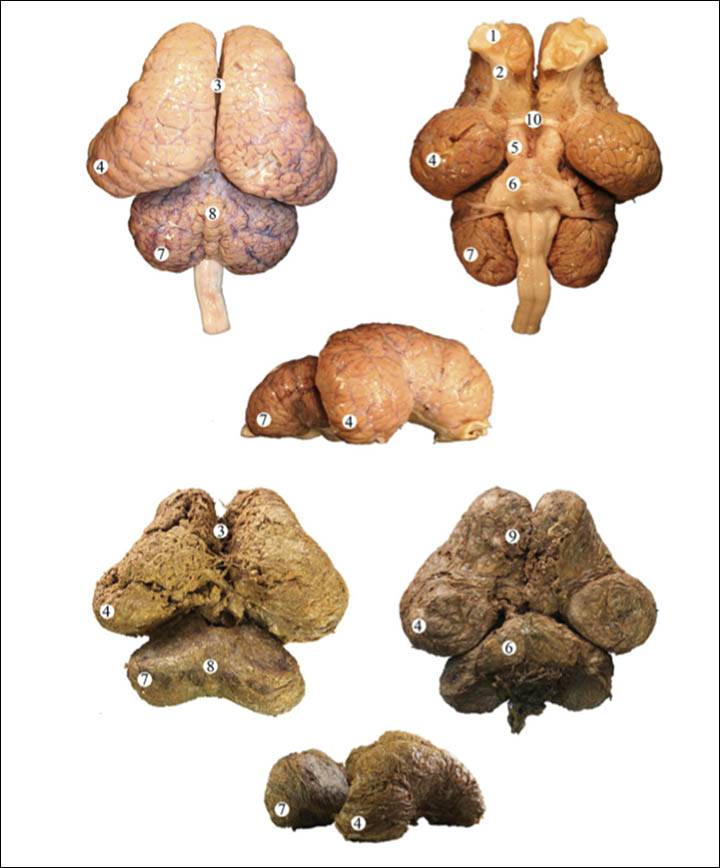 Comparison of brains