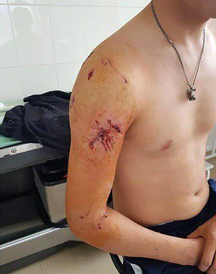 Bear attacks international expedition and drags terrified MA student out of tent