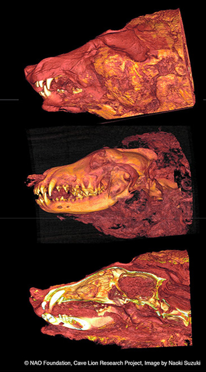 CT scan