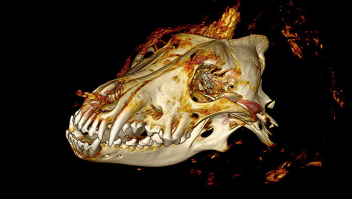 CT scan