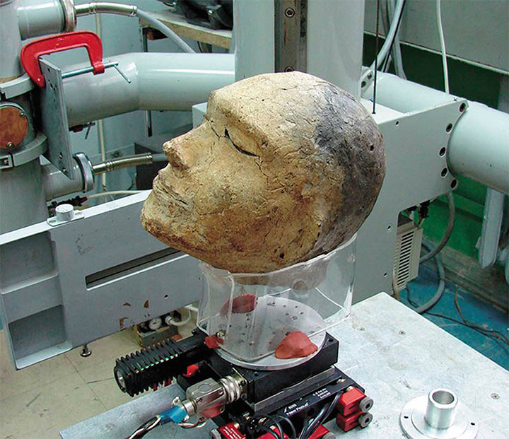 Head prepared for fluoroscopy