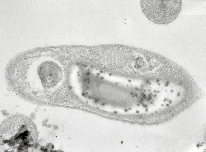 Desulforudis audaxviator